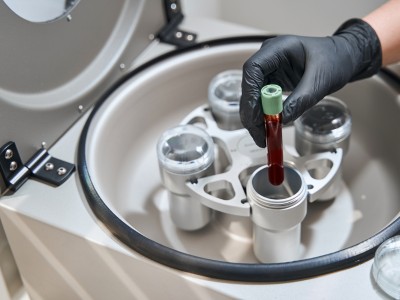 Osocze bogatopłytkowe wir