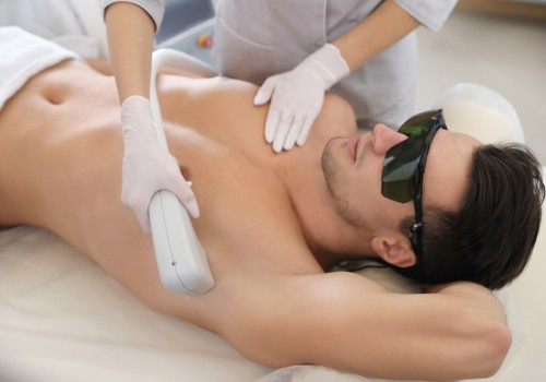 Depilacja laserowa laserem Primelase excellence mężczyzn warszawa