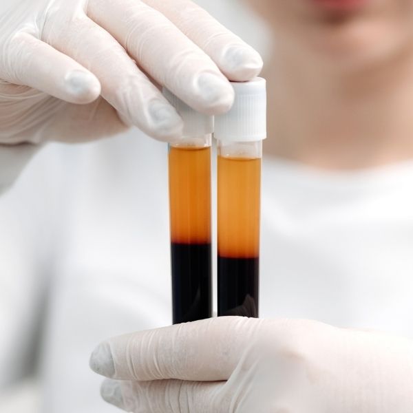 osocze bogatoplytkowe warszawa